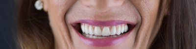 artigo blog beclinique 953x412 implantes dentários