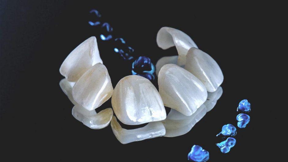 beclinique facetas dentárias