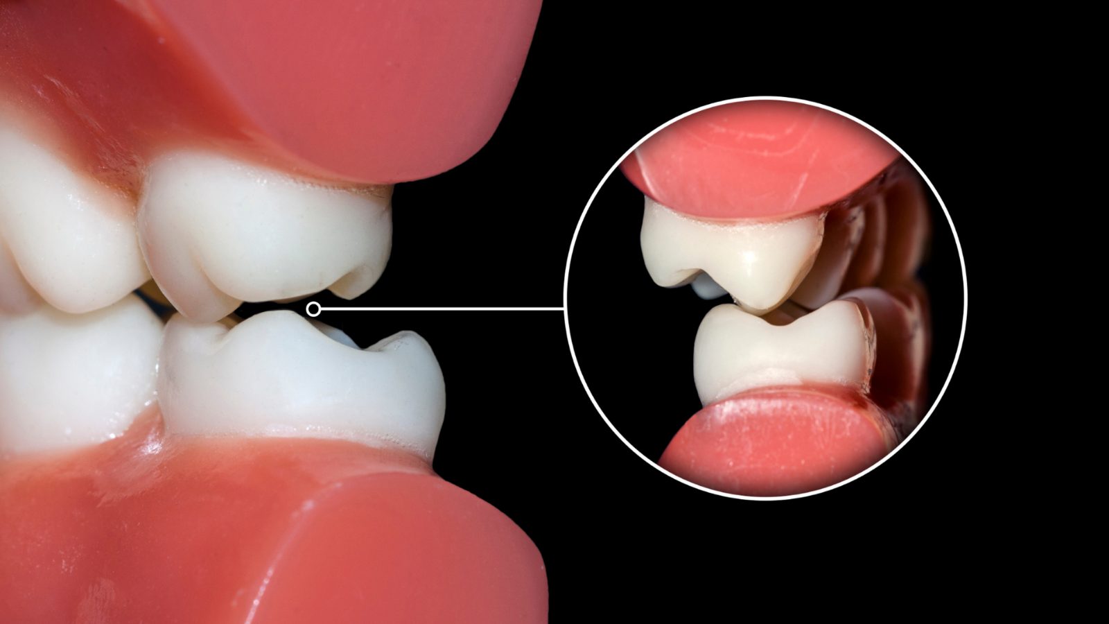 beclinique dental occlusion