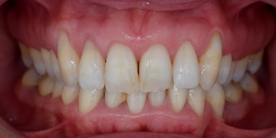 beclinique periodontology