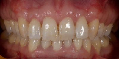 beclinique periodontology
