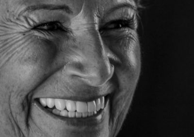 Implantes Dentários Zigomáticos
