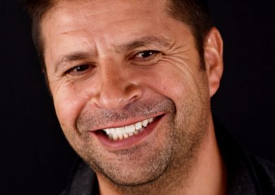 Facetas Dentárias Francisco