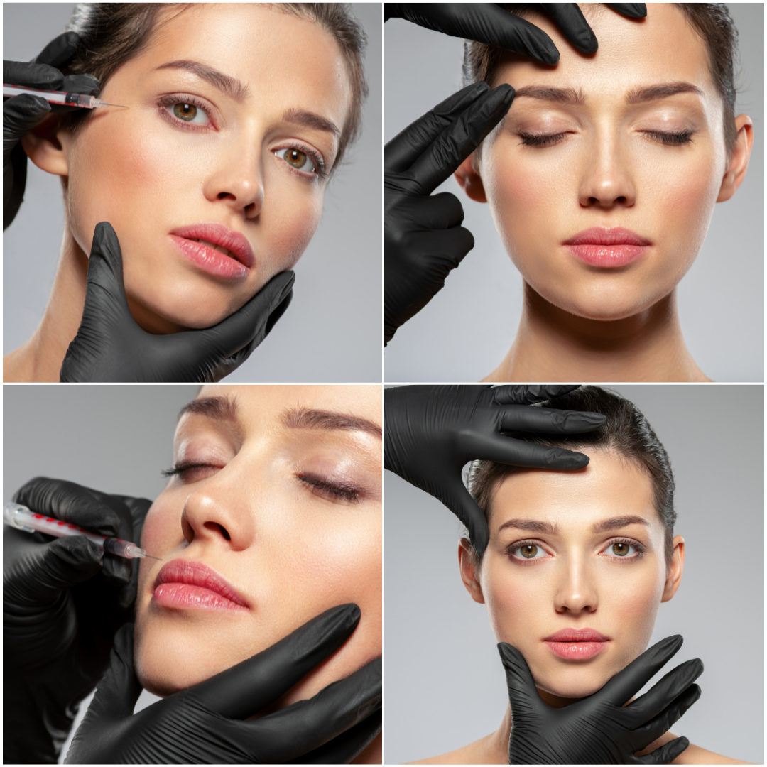 Tratamentos Harmonização Facial Lisboa - Mafra- Algarve - Portimão