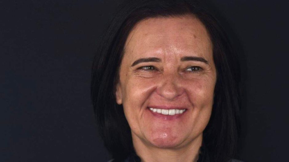 Reabilitação total- Ana Mónica