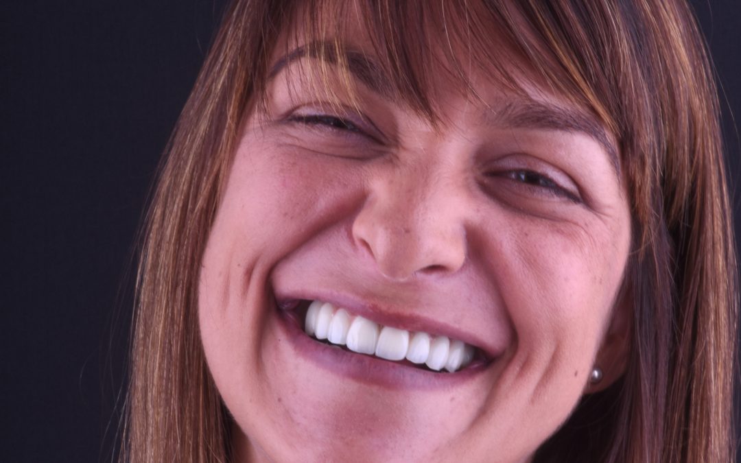 Reabilitação Total Sara Dinis